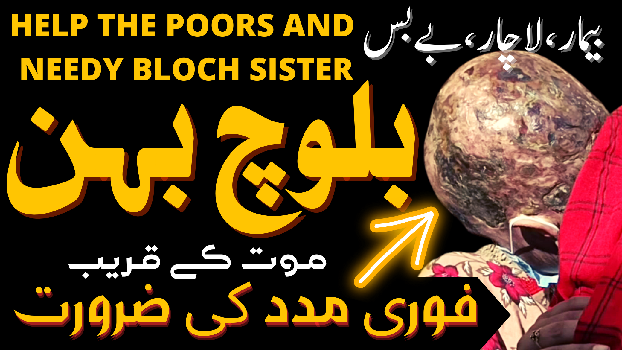 Appeal for treatment of the sick Baloch sister بیمار بلوچ بہن کی علاج اور امداد کی اپیل